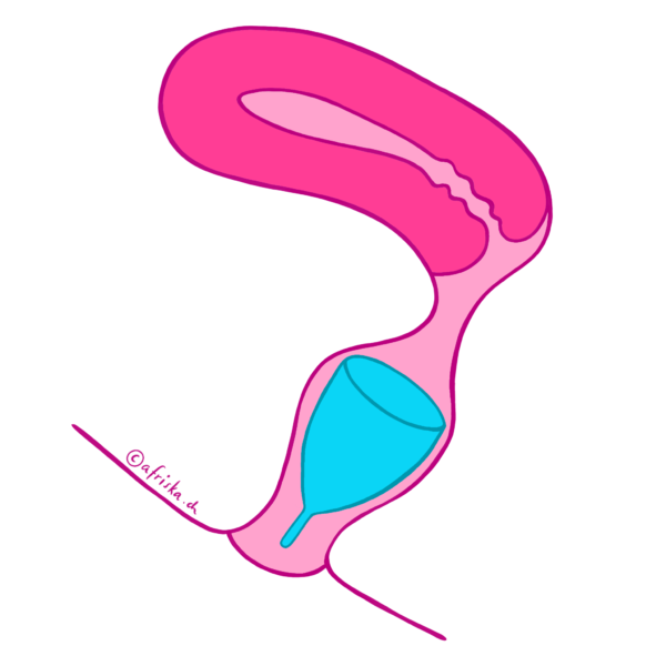 Positionnement de la coupe menstruelle dans le vagin - Copyright Afriska.ch